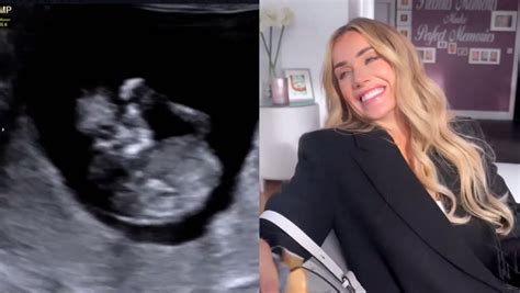 laura anderson baby gender|Pregnant Laura Anderson breaks silence amid Gary Lucy baby。